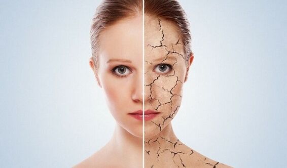 prima e dopo il ringiovanimento della pelle