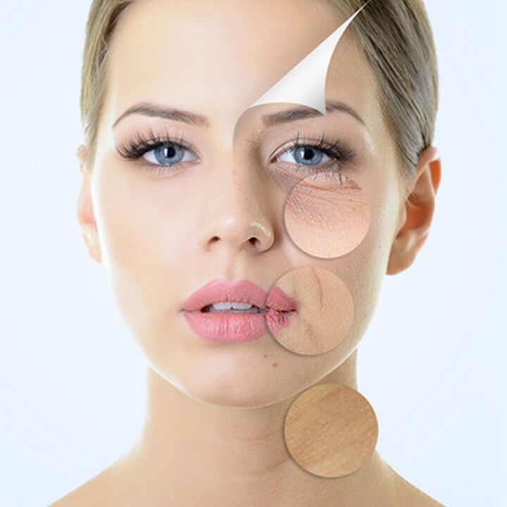 Imperfezioni della pelle del viso - indicazioni per procedure antietà