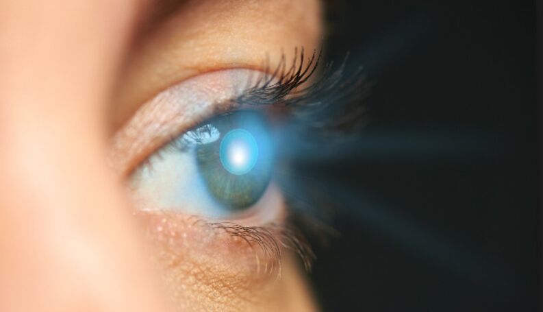 ringiovanimento della pelle intorno agli occhi con un laser