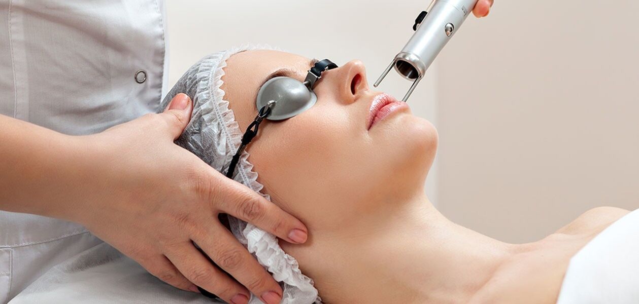 Procedura di peeling laser per il ringiovanimento della pelle del viso